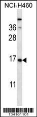 CSRP2 Antibody