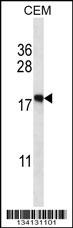 EIF5A2 Antibody
