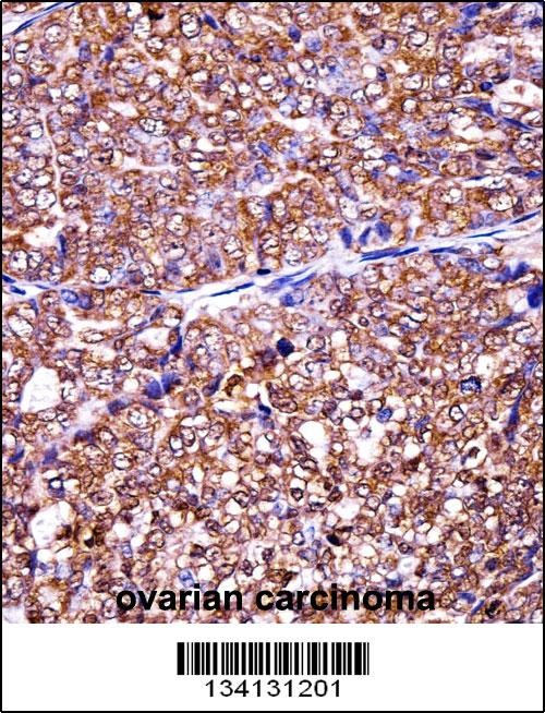 EIF5A2 Antibody