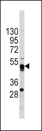 GATA4 Antibody