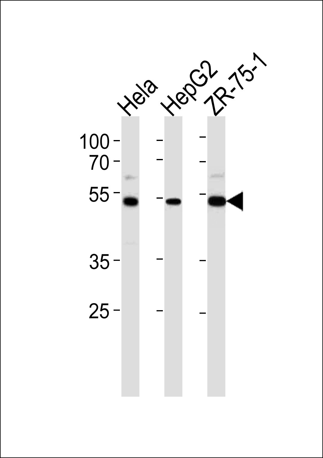 TERF2IP Antibody