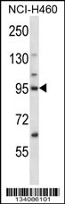 KIF2C Antibody