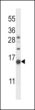 NPPC Antibody