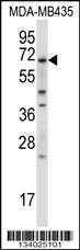 BIRC3 Antibody