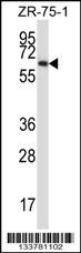 MMP17 Antibody