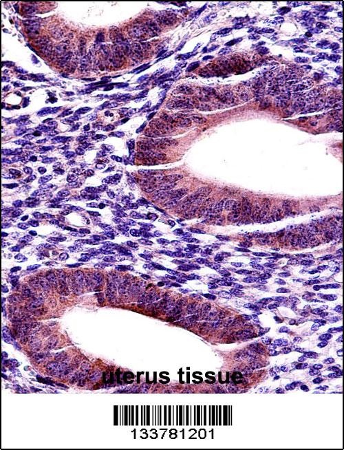 MMP17 Antibody