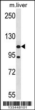 ADNP2 Antibody