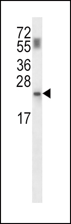 PPCDC Antibody