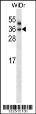 PNPLA4 Antibody