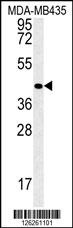 VASH2 Antibody