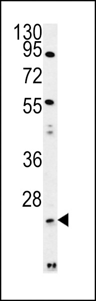 LYPLAL1 Antibody