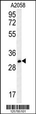 TRIM73 Antibody