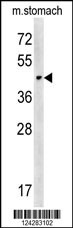 CHST14 Antibody