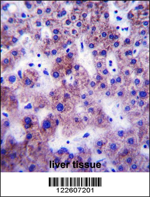 UGT1A1 Antibody