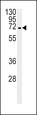 SLC22A1 Antibody