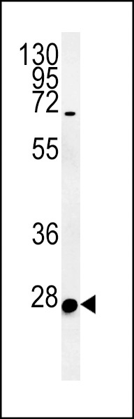 C10orf63 Antibody