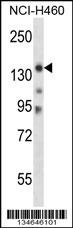 Myo3b Antibody