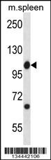 Abl1 Antibody
