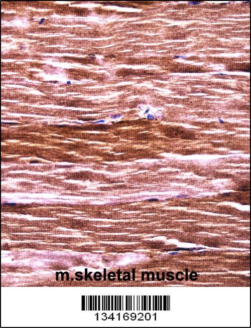 Akt2 Antibody