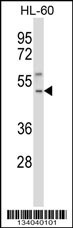 TACR1 Antibody