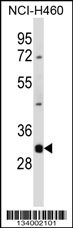DNASE1L3 Antibody