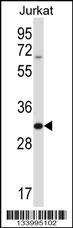 HRASLS5 Antibody