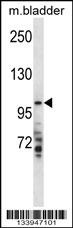 TMPRSS7 Antibody