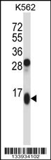 GUCA2A Antibody