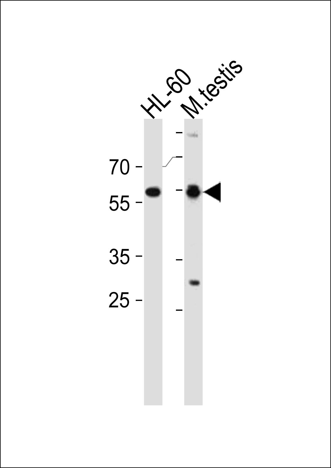 RARA Antibody