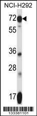 SLC41A2 Antibody