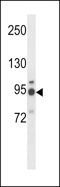 MGAT5 Antibody