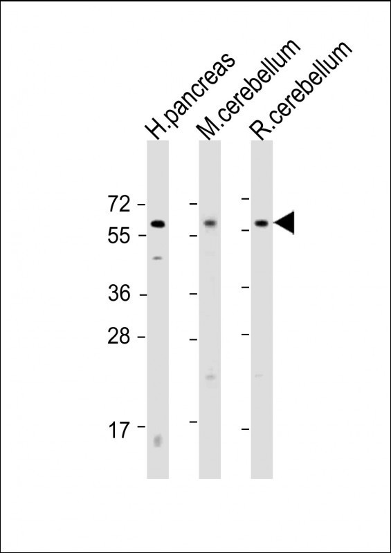 SLC11A2 Antibody