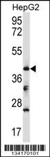 Bckdk Antibody