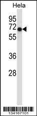 Acvr1 Antibody