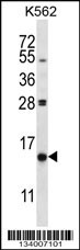 PIK3IP1 Antibody