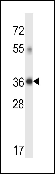 DHRS7C Antibody