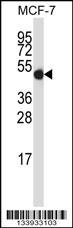 GDI2 Antibody