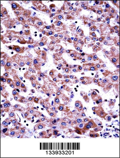 GDI2 Antibody