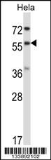 RANGAP1 Antibody
