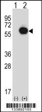 RANGAP1 Antibody