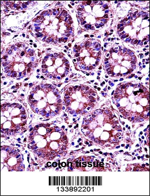 RANGAP1 Antibody