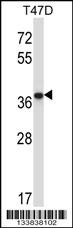PPP2CB Antibody