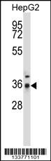 PPP4C Antibody