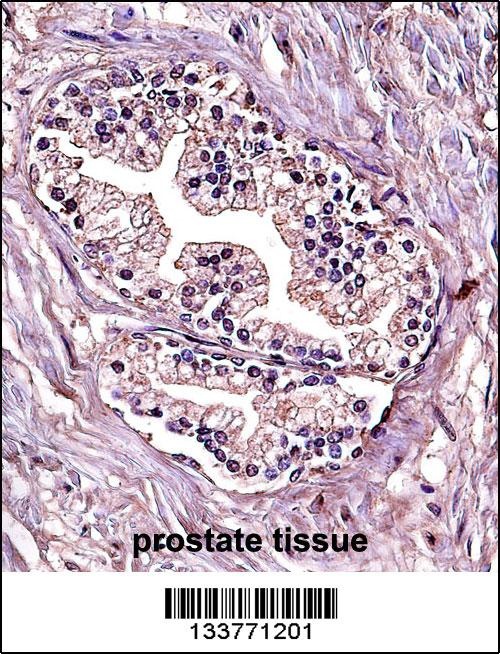 PPP4C Antibody