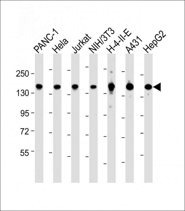 SF3B1 Antibody