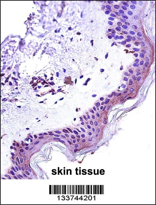 STAT2 Antibody