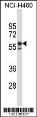 KRT6B Antibody