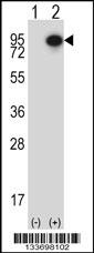 CTTN Antibody