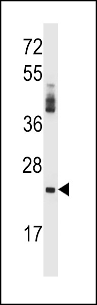 PRSS2 Antibody