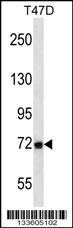 MMP2 Antibody